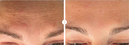 BA 1_300x.png