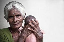 Serie nuestros mayores del portfolio del fotógrafo humanitario y documental Joseba Etxebarria