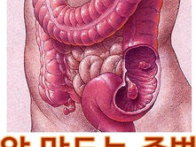 암을 만드는 주범들