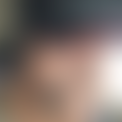 Bob Stanton: "There Aren't Many Groups Fighting for Patients, and Patient Advocacy Is Important"