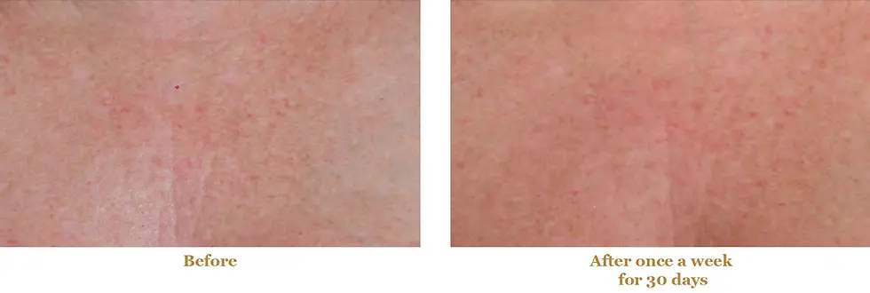 Thumbnail: DIAMONDBUFF™ BODY By Bee Stunning