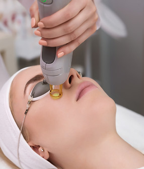 Woman receiving a professional laser treatment under her eye while wearing protective goggles, targeting skin concerns such as fine lines or pigmentation.