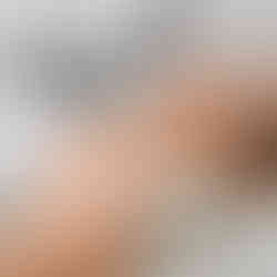 woman lying in clinical setting with IPL device in background