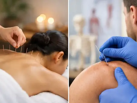 Acupuncture Versus Dry Needling Compared