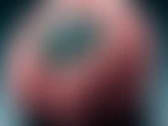 Neuralink вживила перший імплант у мозок людини!