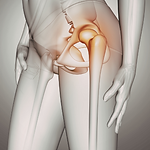 Sacroiliac (SI) Joint Pain.png