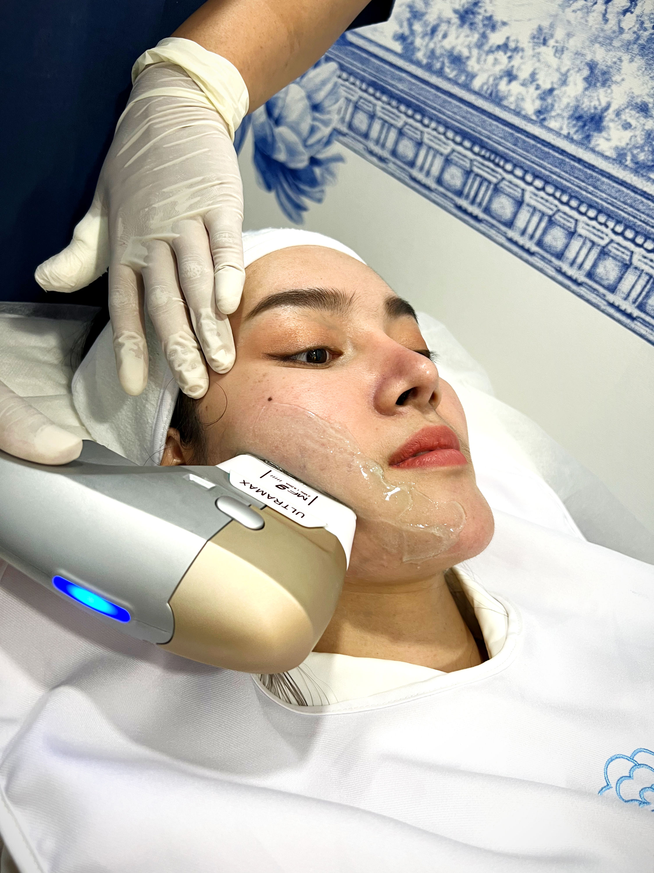 HIFU ยกกระชับผิว