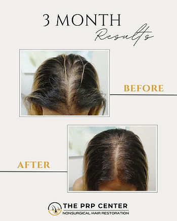 The PRP Center Before & After (1).jpg