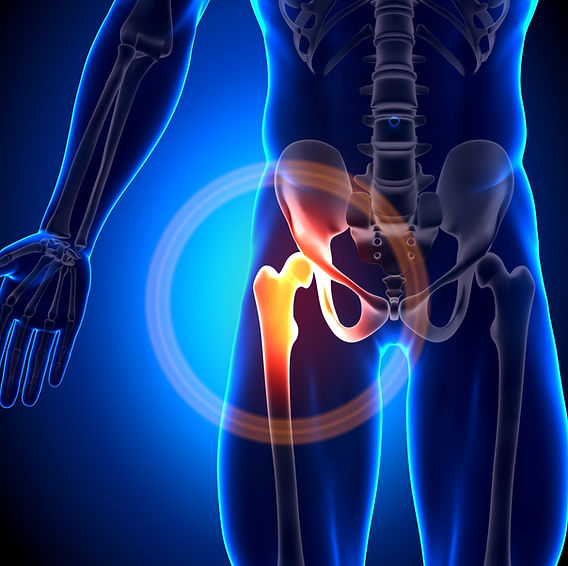 glutathione tendonitis Fluoroquinolone-Induced Achilles Tendon Damage: Structural and Biochemical  Insights into Collagen Type I Alterations main image 1