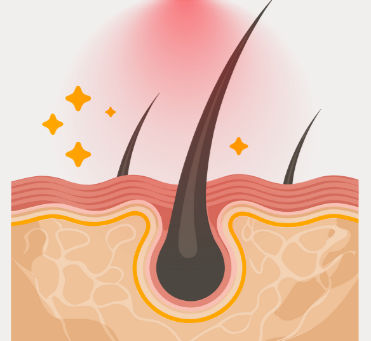 Hair follicles and low-level light therapy