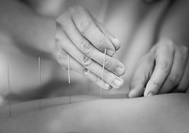 dry needling close up.jpg