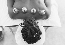 suction cupping therapy on back.jpg