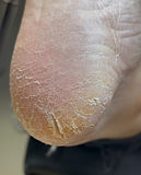 feet 2.jpeg