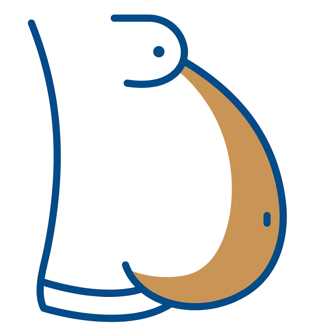 Cirurgia bariátrica - Advogado Especialista.webp
