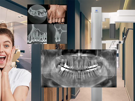 Get World Class Images with J. Morita X800 CBCT: Settings & Positioning Guide