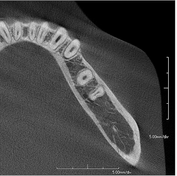 0.3 mm focal spot