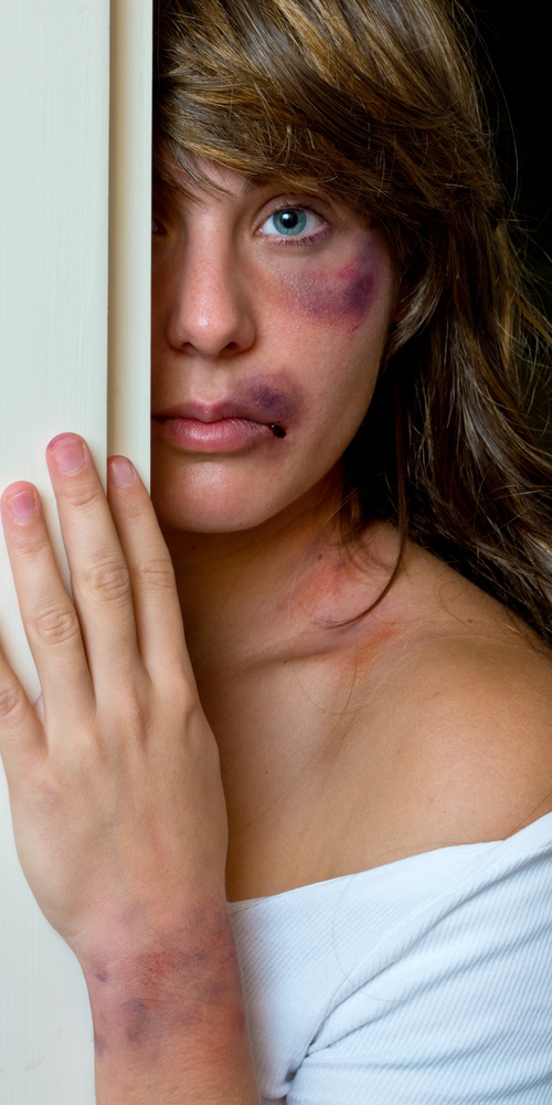 Abused woman with bruises on her face hiding and peeking out from behind a door