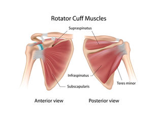 "I tore my Rotator Cuff"