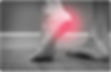 plantar fasciitis