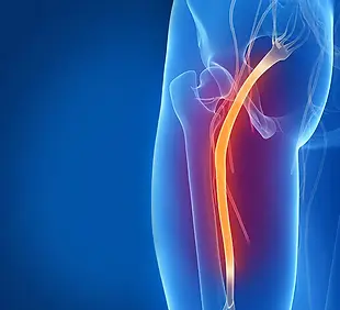 3D illustration of sciatica pain – Physiotherapy for sciatica relief, nerve pain treatment, and mobility rehabilitation.