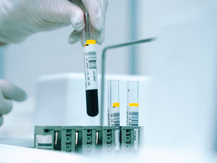 New test to track how medicines 'hitchhike' on cholesterol