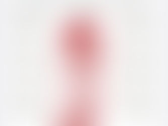 Impacts of Health Attacks in the West Bank