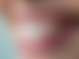 Ești Mireasă dorești zâmbetul visat într-o singură programare?