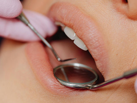 Importanța profilaxiei dentare pentru sănătatea orală și prevenirea problemelor dentare