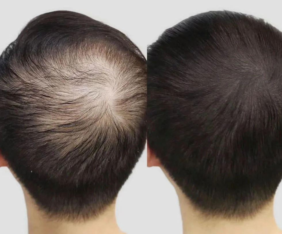 Thumbnail: Lustrao Hair Regrowth Oil