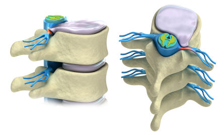 iStock_000015419908_ExtraSmall.jpg