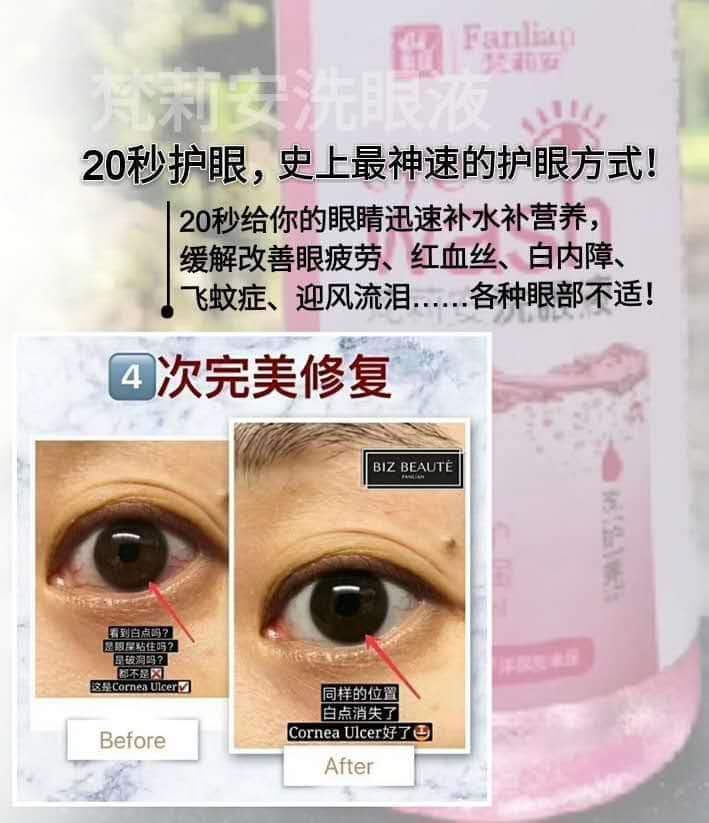 縮圖：梵莉安洗眼液