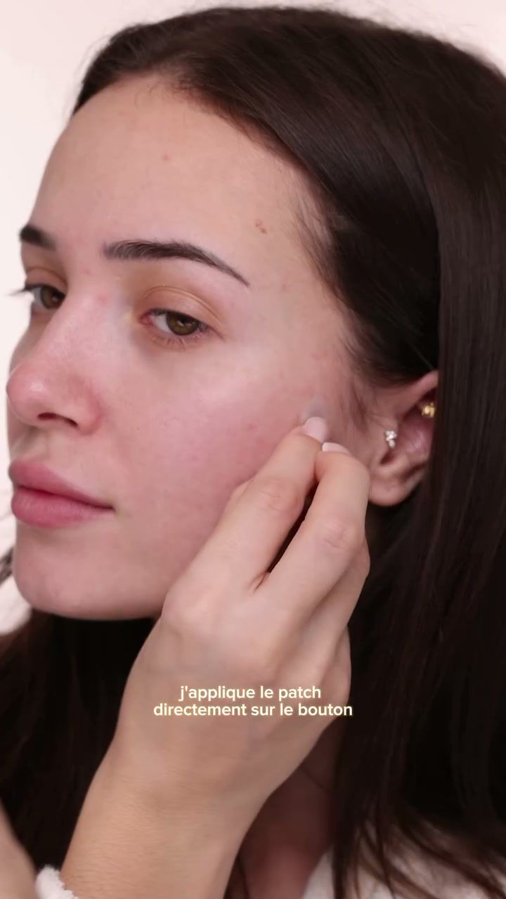 Miniature : PATCH ANTI-ACNE (24 PATCHS) - LE COMPTOIR DES TENDANCES 