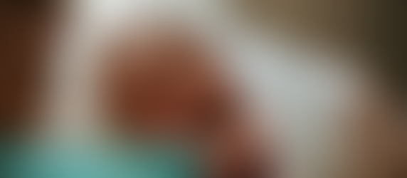 Newborn baby resting on parent’s bare chest during kangaroo care