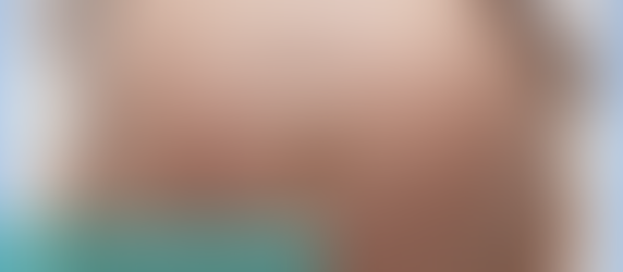 Stretch Marks During Pregnancy: Causes, Treatments, and How to Embrace Them