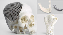 How 3D Printing changing the medical field