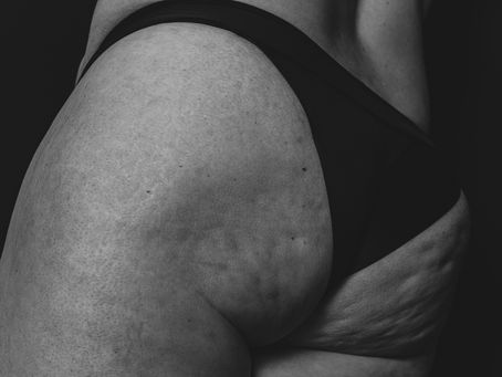 Life Body : Accepter son corps tel qu'il est