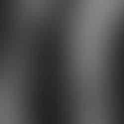 Femme posant avec ses vergetures pour lutter contre le summer body et promouvoir l'estime de soi