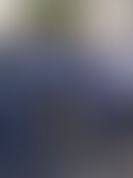 Cirurgias de Catarata pelo SUS passam a ser feitas em Varginha