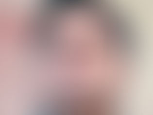 Diagnóstico confirma carcinoma em Jair Bolsonaro, segundo equipe médica