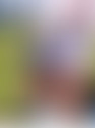 Marlon sofre fratura no tornozelo, passa por cirurgia e desfalca o Grêmio por até cinco meses