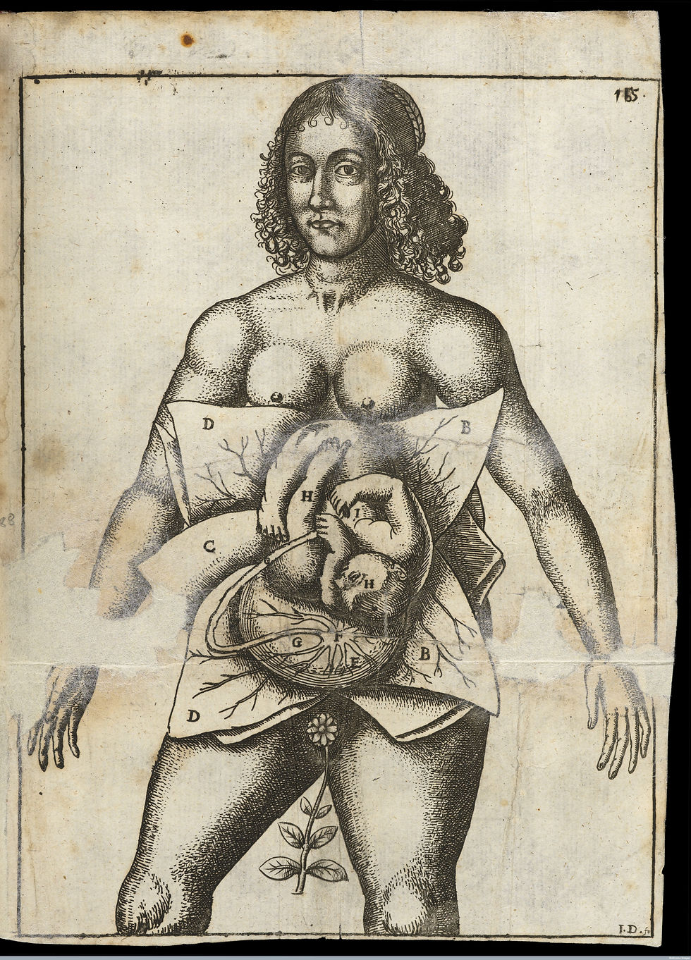  Jane Sharp, The Midwives Book, London, 1671.