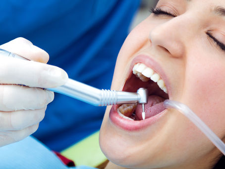 How Often Should You Get Scaling and Polishing for Healthy Teeth?