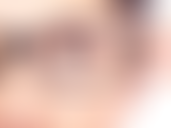 Dấu hiệu kính lệch tâm: Nhận biết sớm để bảo vệ thị lực