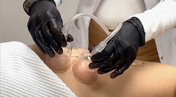 winkcupping_edited.jpg