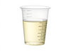 a sterile specimen container cup of urine sample, the kind you commonly see at a hospital,