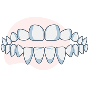 open-bite (1).png