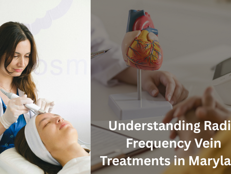 Understanding Radio Frequency Vein Treatments in Maryland