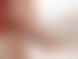 Varicose Veins Treatments in Maryland: Advanced Care at Maryland Specialty Group