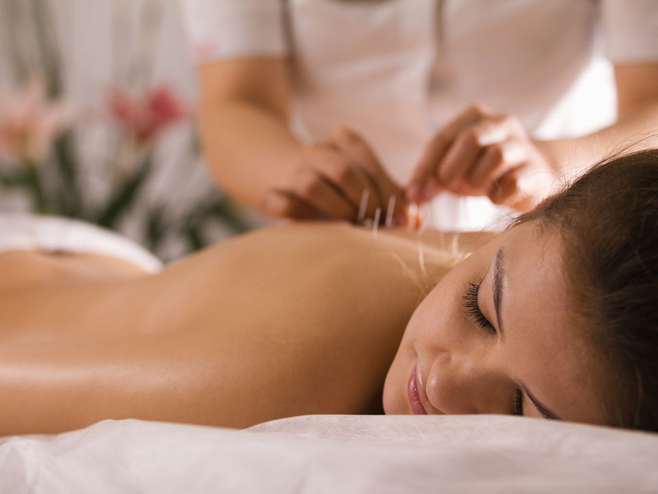 Patiente sur une table de massage avec aiguilles