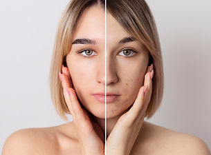 before-after-portrait-woman-retouched.jpg
